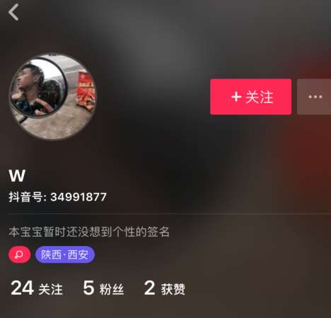 抖音怎么取消關(guān)注？抖音取消關(guān)注步驟一覽